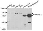 Heparin Cofactor II Antibody in Western Blot (WB)