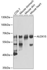 ALOX15 Antibody in Western Blot (WB)