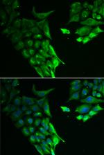 HABP2 Antibody in Immunocytochemistry (ICC/IF)