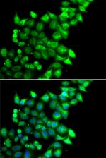 MEST Antibody in Immunocytochemistry (ICC/IF)