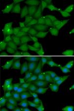 RASGRF1 Antibody in Immunocytochemistry (ICC/IF)