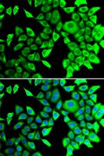 THADA Antibody in Immunocytochemistry (ICC/IF)