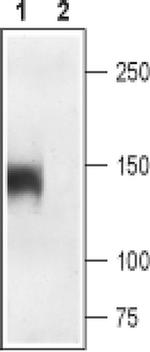 CaV1.1 (extracellular) Antibody in Western Blot (WB)