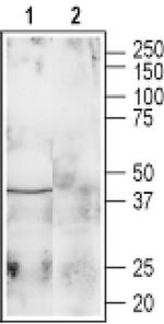 GALR1 Antibody in Western Blot (WB)