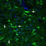 GLP2R (extracellular) Antibody in Immunohistochemistry (IHC)