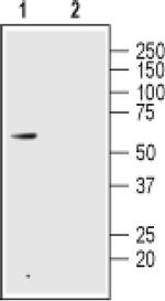 GLP2R (extracellular) Antibody in Western Blot (WB)