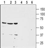 NTSR1 (extracellular) Antibody in Western Blot (WB)