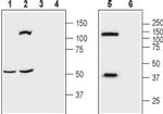 OPRK1 (extracellular) Antibody in Western Blot (WB)