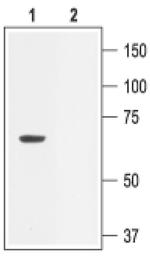 KCNN2 Antibody in Western Blot (WB)