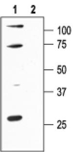 KCNN1 Antibody in Western Blot (WB)