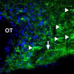 P2X1 Antibody in Immunohistochemistry (IHC)