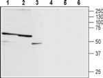 P2X2 (extracellular) Antibody in Western Blot (WB)