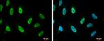 PARP1 (cleaved Asp214) Antibody in Immunocytochemistry (ICC/IF)