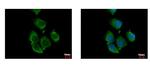 RhoC Antibody in Immunocytochemistry (ICC/IF)