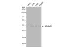 RhoGAP Antibody in Western Blot (WB)