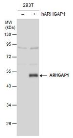 RhoGAP Antibody in Western Blot (WB)