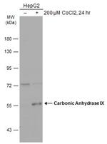 Carbonic Anhydrase IX Antibody in Western Blot (WB)