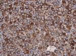 Cdc25A Antibody in Immunohistochemistry (Paraffin) (IHC (P))