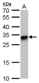 HLA-DQB1 Antibody in Western Blot (WB)