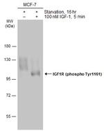 Phospho-IGF1R beta (Tyr1131) Antibody in Western Blot (WB)