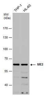 ME2 Antibody in Western Blot (WB)