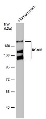 CD56 (NCAM) Antibody in Western Blot (WB)