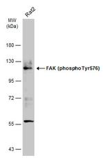 Phospho-FAK (Tyr576) Antibody in Western Blot (WB)