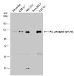 Phospho-FAK (Tyr576) Antibody in Western Blot (WB)