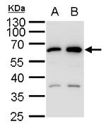 SQSTM1 Antibody in Western Blot (WB)