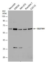 SQSTM1 Antibody in Western Blot (WB)