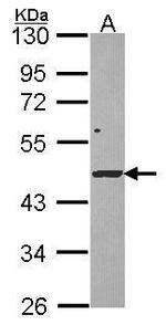 DRAK1 Antibody in Western Blot (WB)