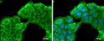 ROCK2 Antibody in Immunocytochemistry (ICC/IF)