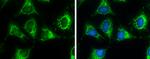 ACAA2 Antibody in Immunocytochemistry (ICC/IF)