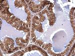 ACAA2 Antibody in Immunohistochemistry (Paraffin) (IHC (P))