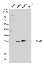 RAB32 Antibody in Western Blot (WB)