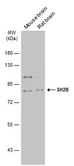 SH2B1 Antibody in Western Blot (WB)