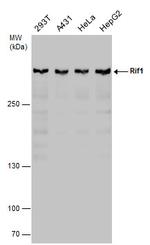 RIF1 Antibody in Western Blot (WB)