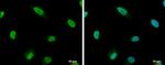 RIF1 Antibody in Immunocytochemistry (ICC/IF)