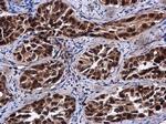 RIF1 Antibody in Immunohistochemistry (Paraffin) (IHC (P))