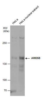 ARID5B Antibody in Western Blot (WB)