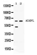 ACADVL Antibody in Western Blot (WB)