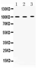 ADAM2 Antibody in Western Blot (WB)