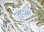 AKR1B10 Antibody in Immunohistochemistry (Paraffin) (IHC (P))