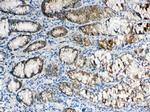 ALDH1A3 Antibody in Immunohistochemistry (Paraffin) (IHC (P))