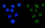 API5 Antibody in Immunocytochemistry (ICC/IF)