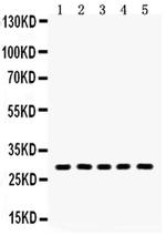 Aquaporin 1 Antibody in Western Blot (WB)