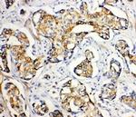 SERCA2 ATPase Antibody in Immunohistochemistry (Paraffin) (IHC (P))