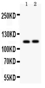 SERCA2 ATPase Antibody in Western Blot (WB)