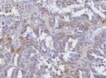 BCAT1 Antibody in Immunohistochemistry (Paraffin) (IHC (P))