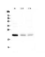 BNIP3 Antibody in Western Blot (WB)